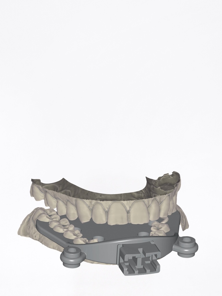 DentalCAD - Modulo Jaw Motion Import