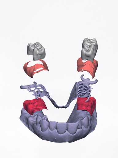 DentalCAD - Modulo PartialCAD Stand Alone
