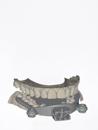 ChairsideCAD - Modulo Jaw Motion