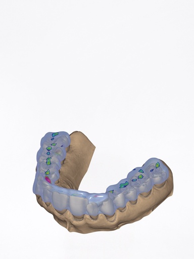 DentalCAD - Modulo Bite Splint con Articolatore Virtuale Stand Alone