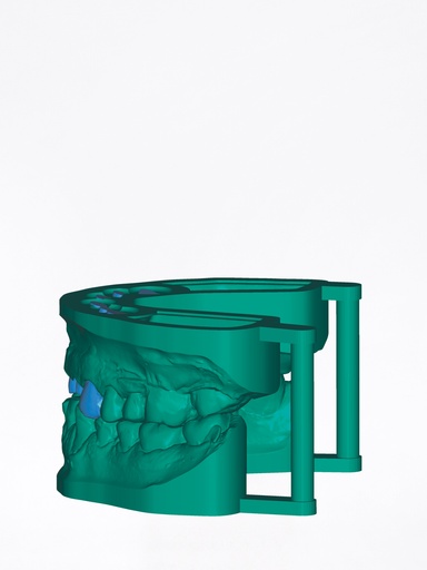 ChairsideCAD - Modulo Model Creator con Analoghi Implantari Stand Alone